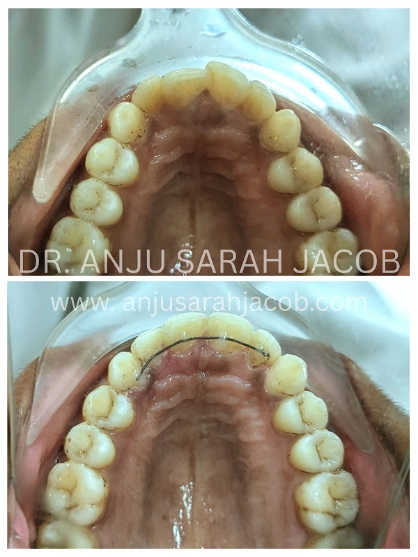 Case 06, view 4 of 9