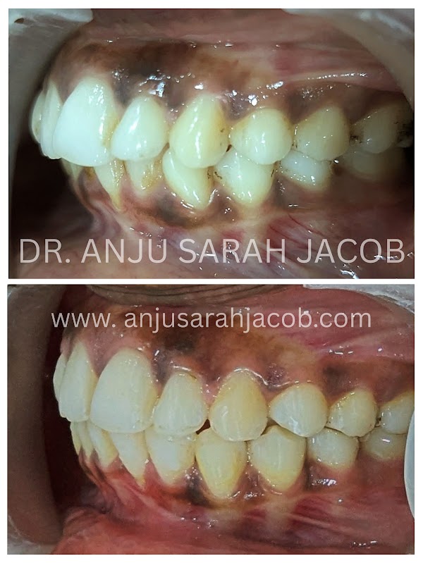 Case 06, view 3 of 9