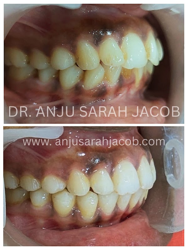 Case 06, view 2 of 9