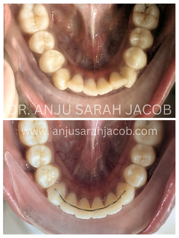 Case 07, view 5 of 9