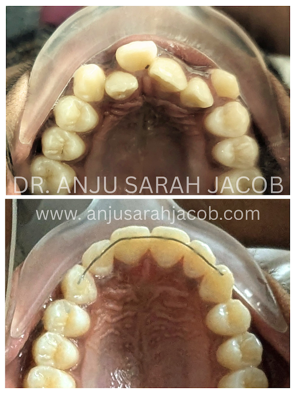 Case 07, view 4 of 9