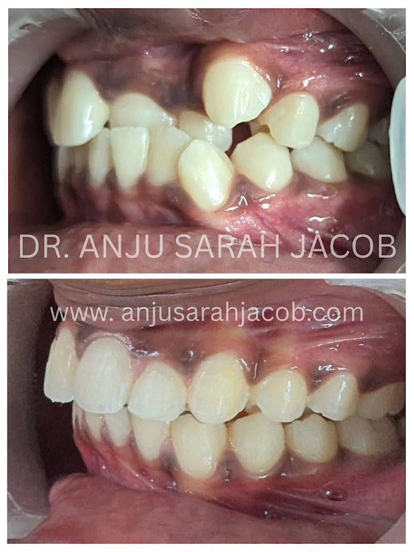 Case 07, view 3 of 9