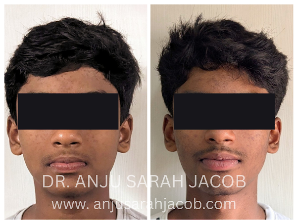 Case 07, view 6 of 9