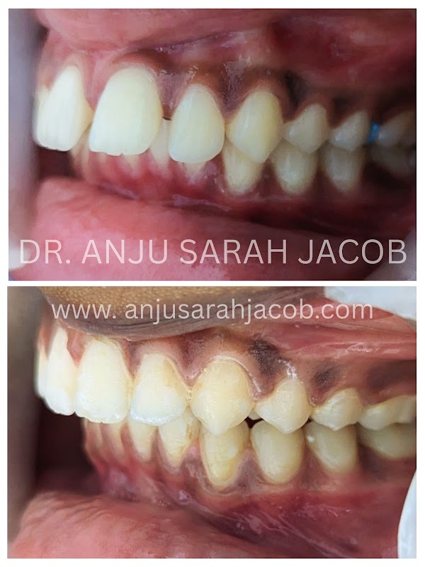 Case 01, view 3 of 9