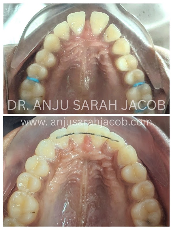 Case 01, view 4 of 9