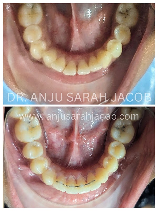 Case 01, view 5 of 9