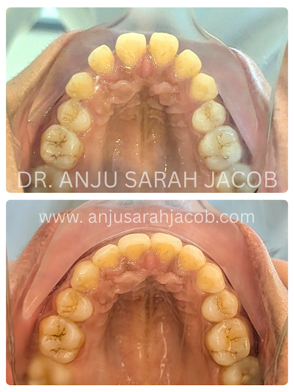 Case 11, view 4 of 9