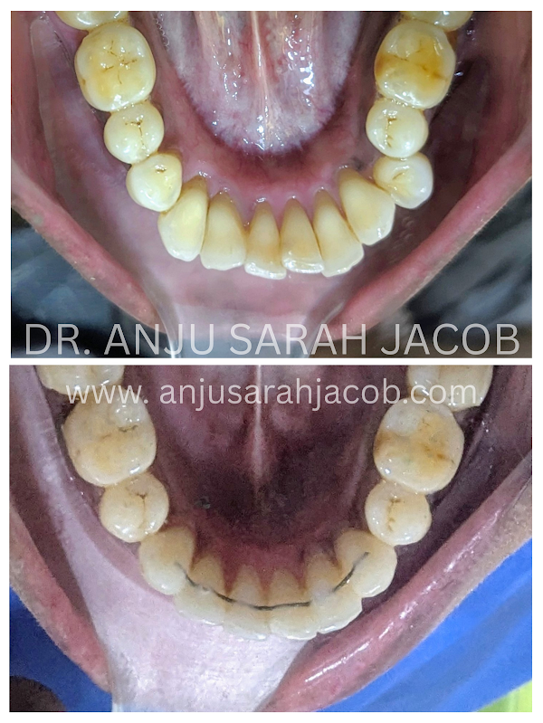 Case 05, view 5 of 9