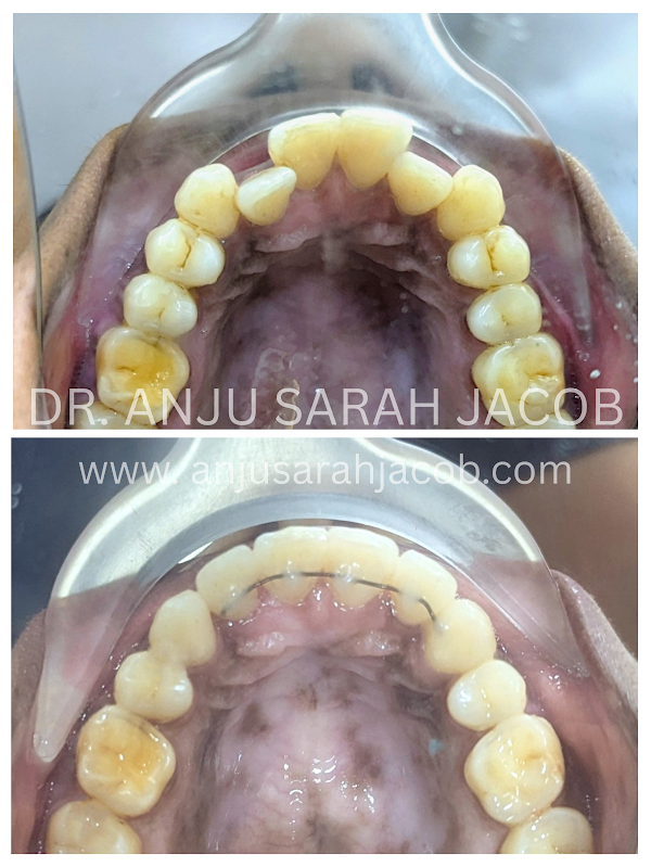Case 05, view 4 of 9