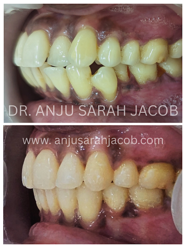 Case 05, view 3 of 9