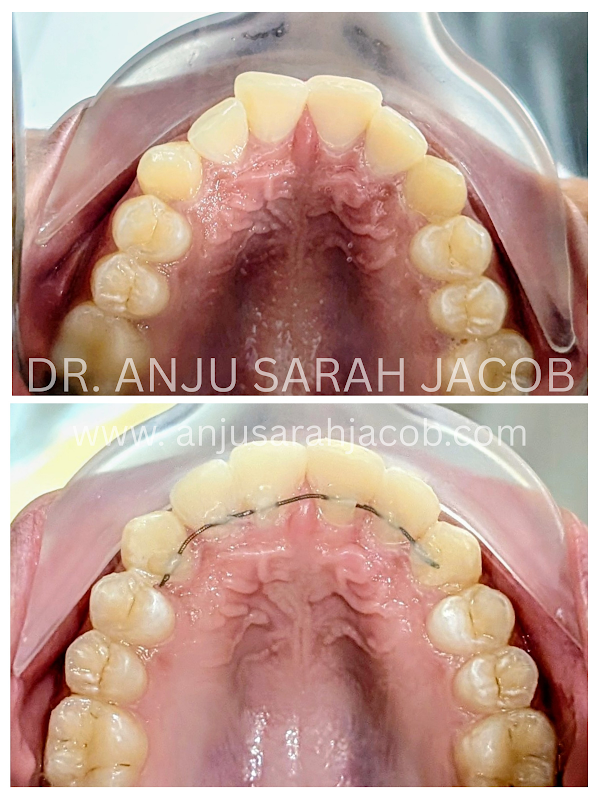 Case 09, view 4 of 9