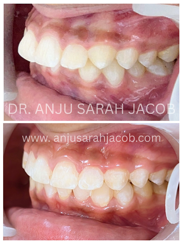 Case 09, view 3 of 9
