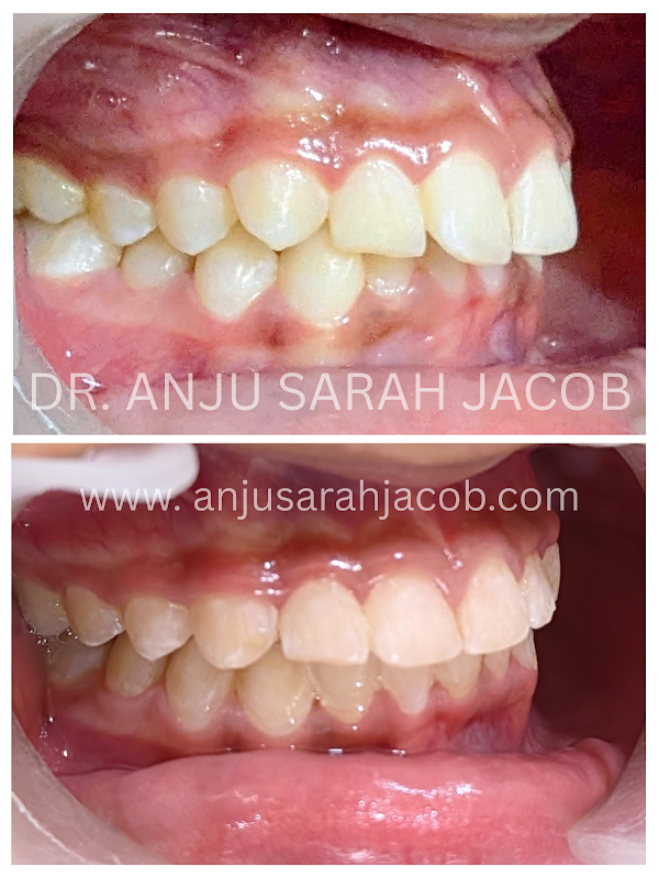 Case 09, view 2 of 9