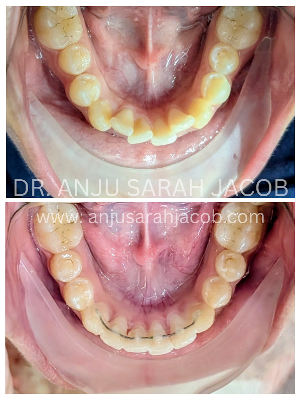 Case 09, view 5 of 9