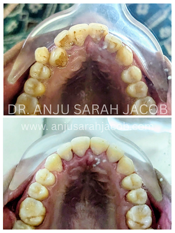 Case 14, view 4 of 9
