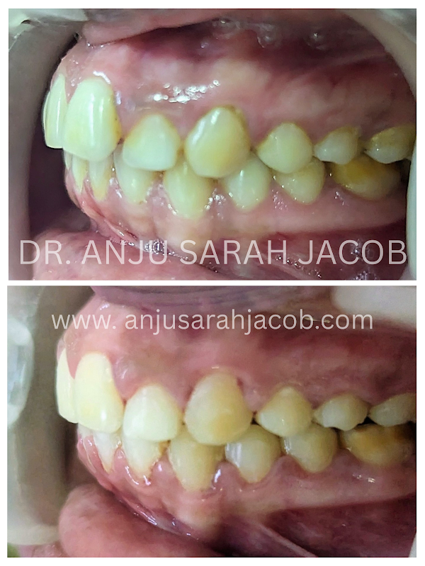 Case 14, view 3 of 9