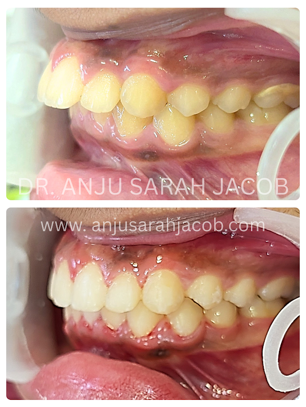 Case 16, view 3 of 9