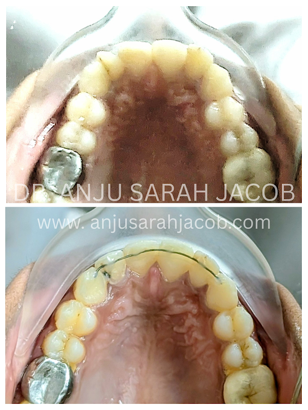Case 10, view 4 of 9