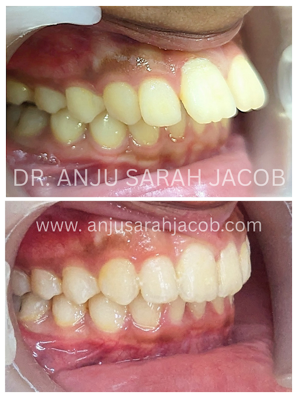 Case 03, view 2 of 9