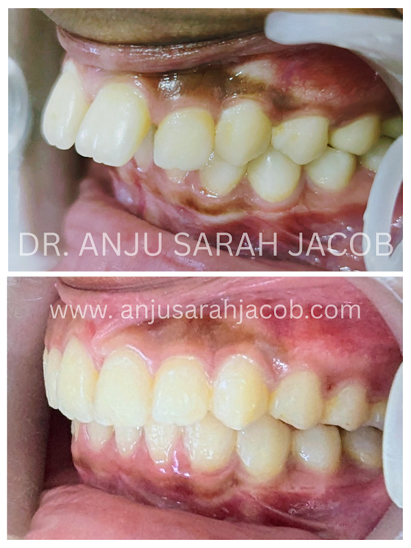Case 03, view 3 of 9
