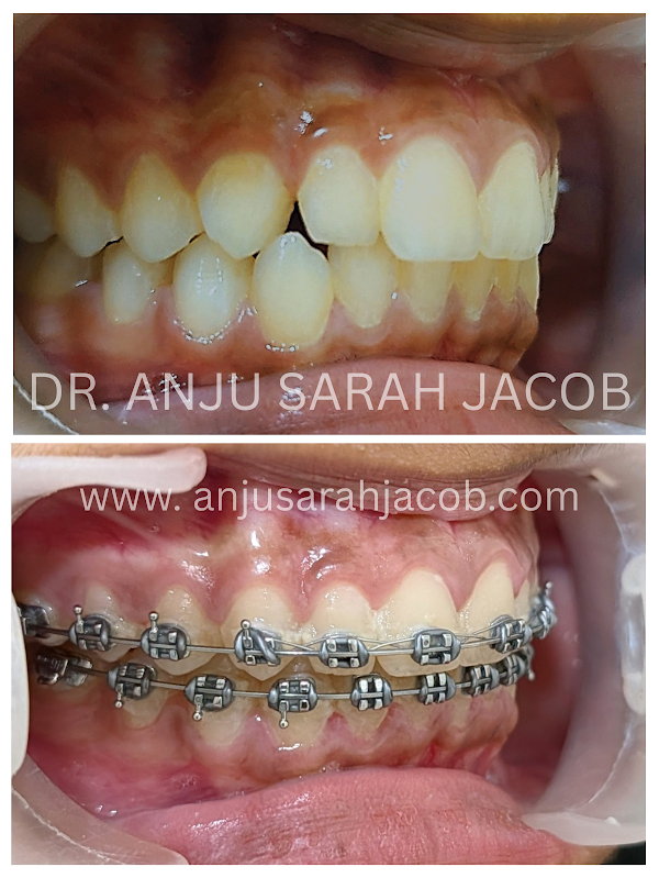 Case 08, view 2 of 9