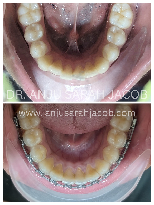 Case 08, view 5 of 9