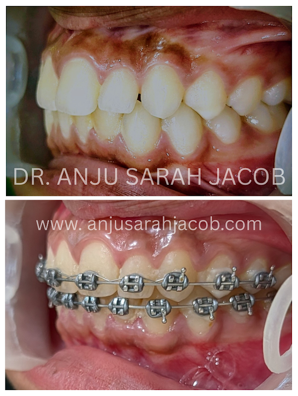 Case 08, view 3 of 9