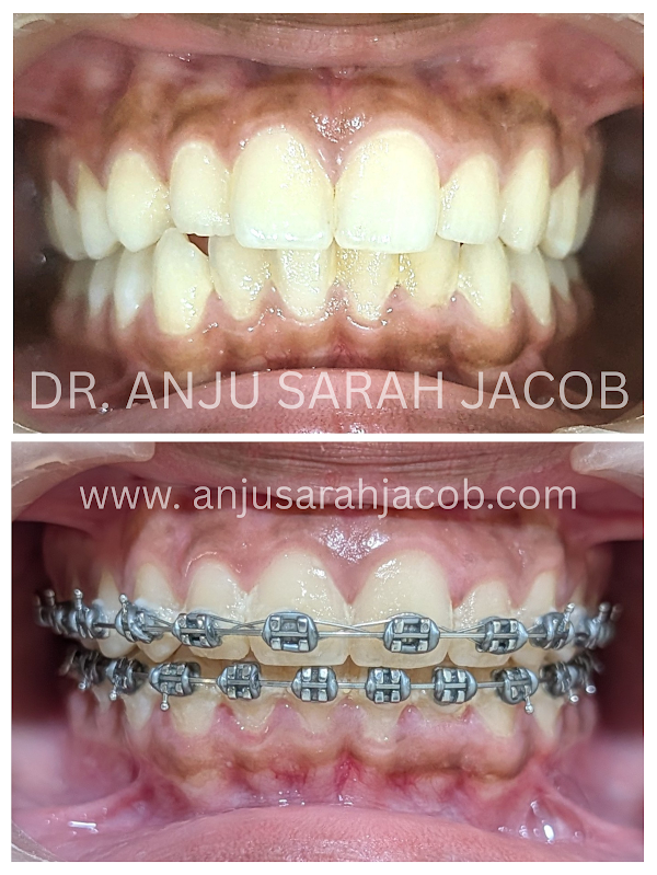 Case 08, view 1 of 9