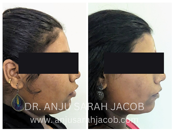 Case 04, view 7 of 9