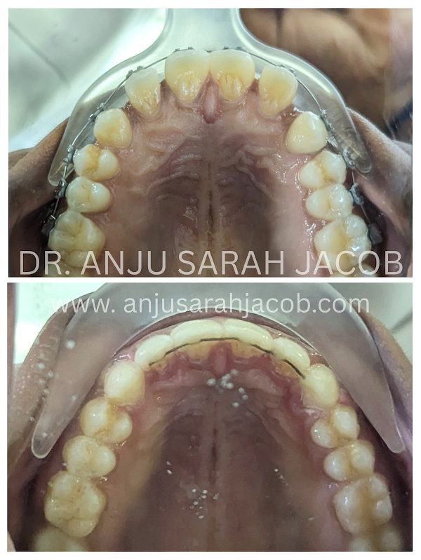 Case 04, view 4 of 9