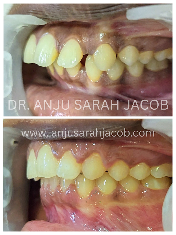 Case 04, view 3 of 9