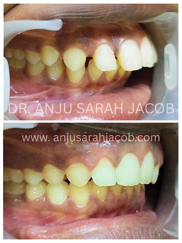 Case 04, view 2 of 9