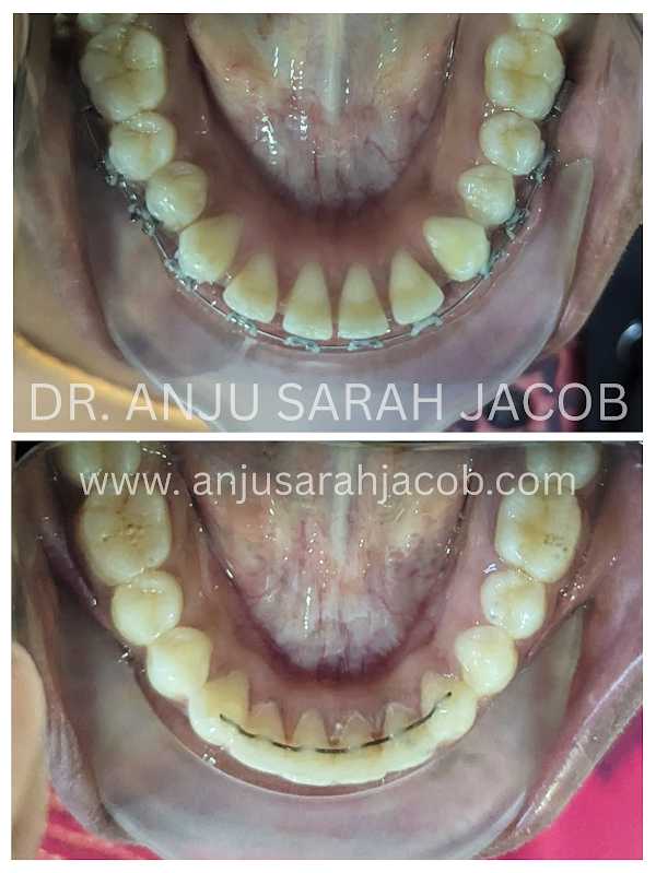 Case 04, view 5 of 9