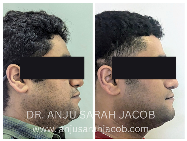 Case 02, view 7 of 9