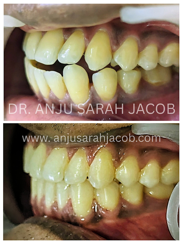 Case 02, view 3 of 9