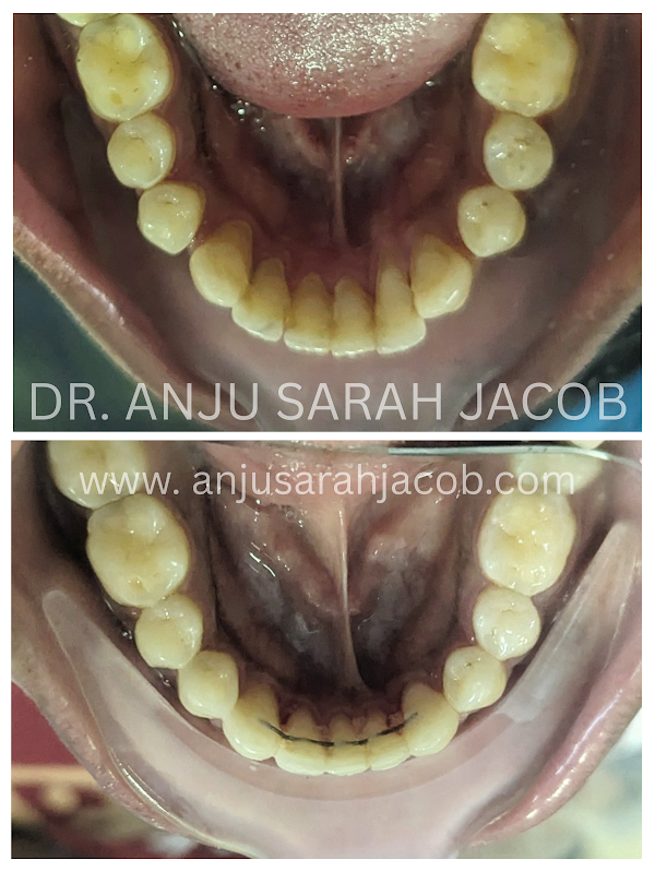 Case 02, view 5 of 9