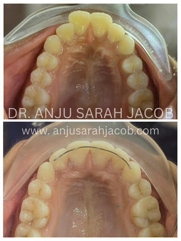 Case 15, view 4 of 9